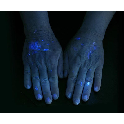 Nextorch Dr.K3 UV medicínska baterka